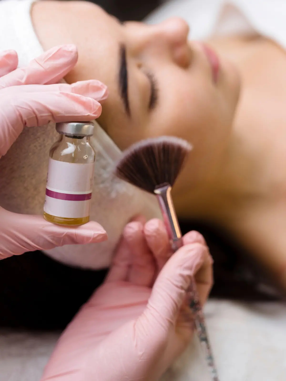 Chemical Peels London